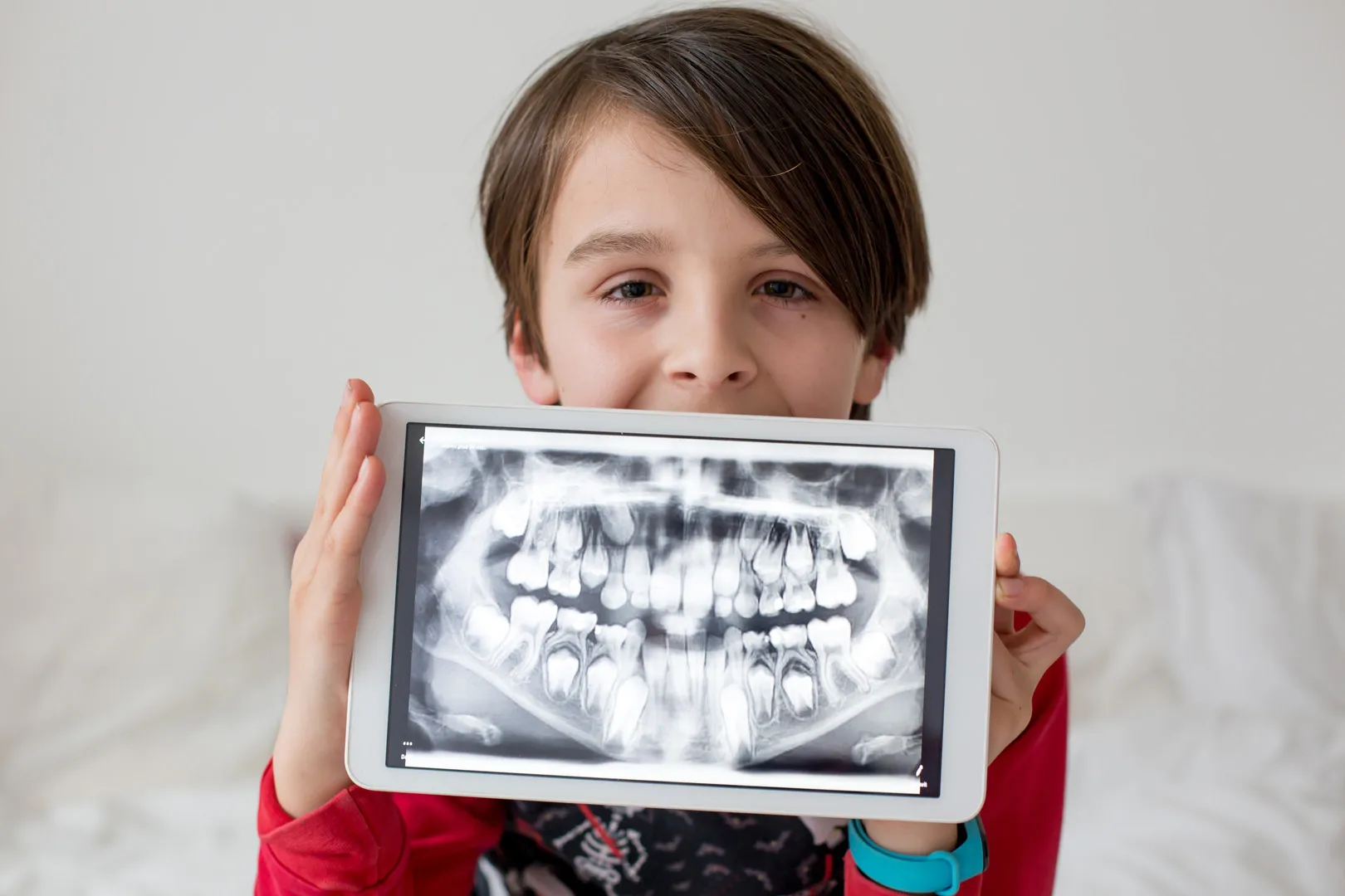 Dental X-rays
